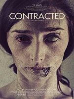 Contracted posteri