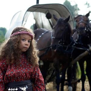 Fotoğraf Güneş Yanığı 2