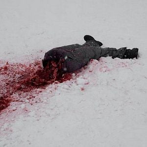 Fotoğraf Hypothermia