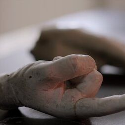 Fotoğraf Surviving Death