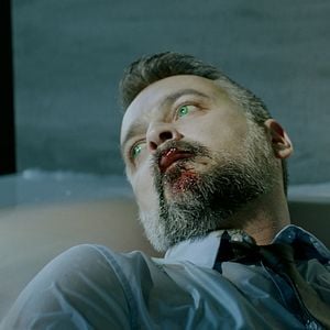 Fotoğraf Brain Freeze