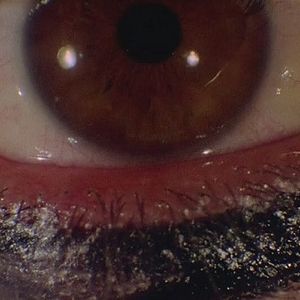 Fotoğraf Derin Kırmızı