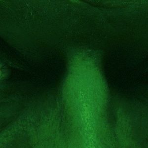 Fotoğraf L'étrange couleur des larmes de ton corps