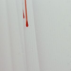 Fotoğraf Her Gün Başka Bir Bela