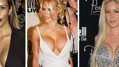 Estetik Yaptırdığına Pişman Olan 10 Ünlü! haber görseli