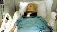 Malkoçoğlu Felç Oldu! haber görseli